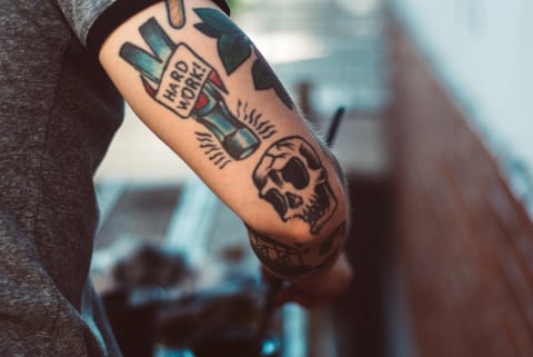 Laser Tattoo Removal