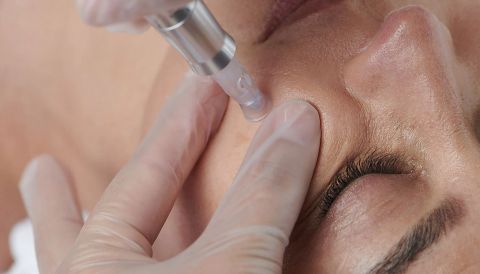 Microneedling at Ivy Lounge, Rosyth
