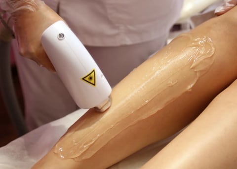 Carbon Laser Facial